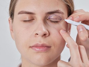 ¿Cómo recuperar la juventud en sus ojos con una blefaroplastia?