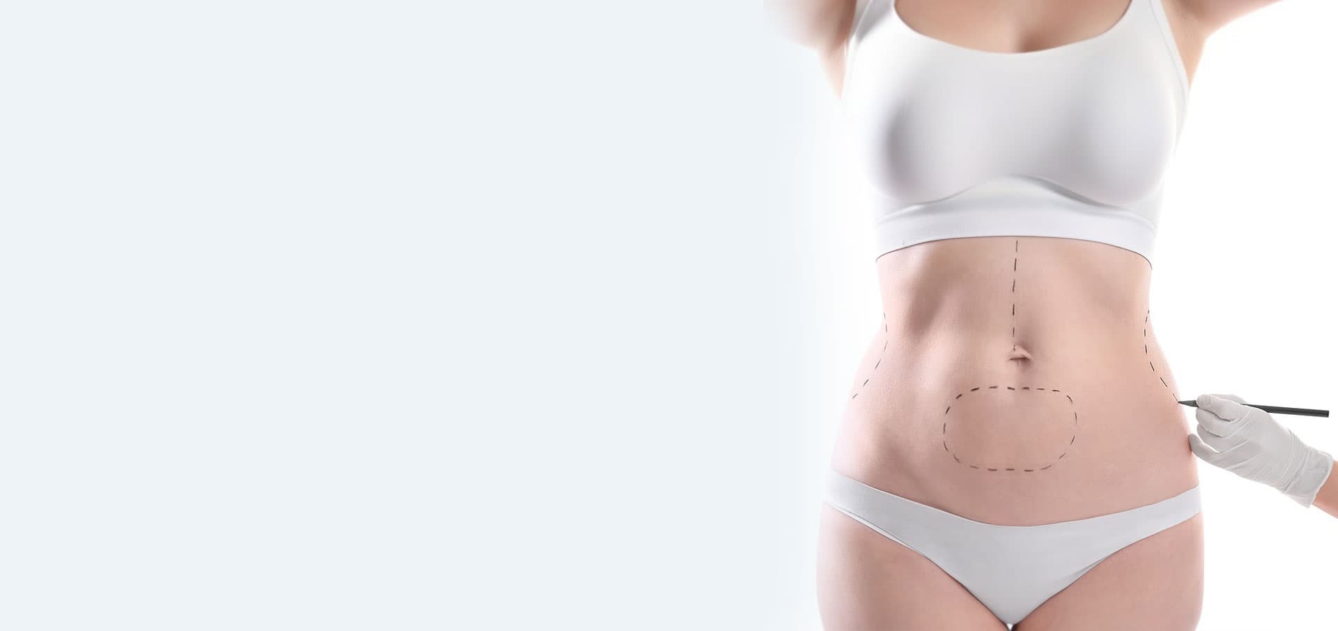 Abdominoplastia en Santiago y Pontevedra