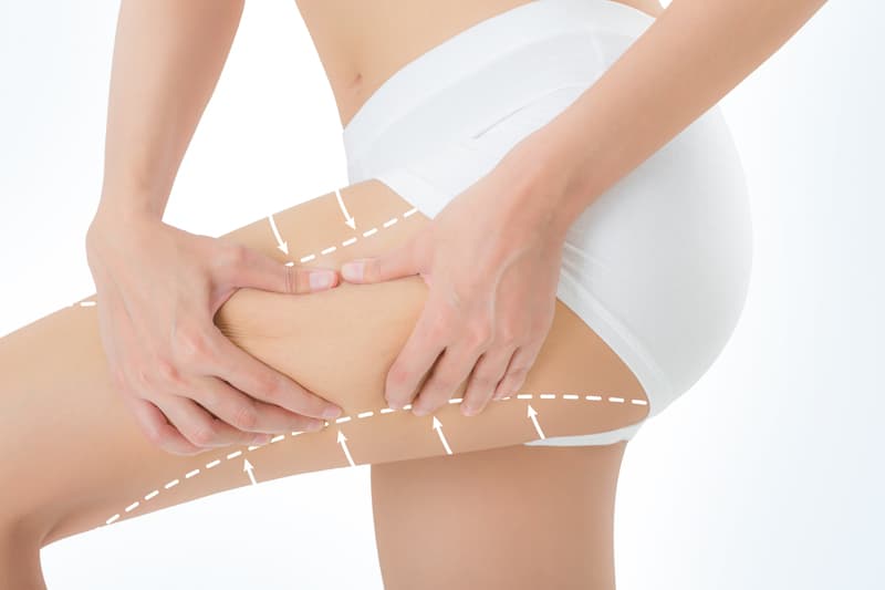 Lipoaspiración en Santiago y Pontevedra