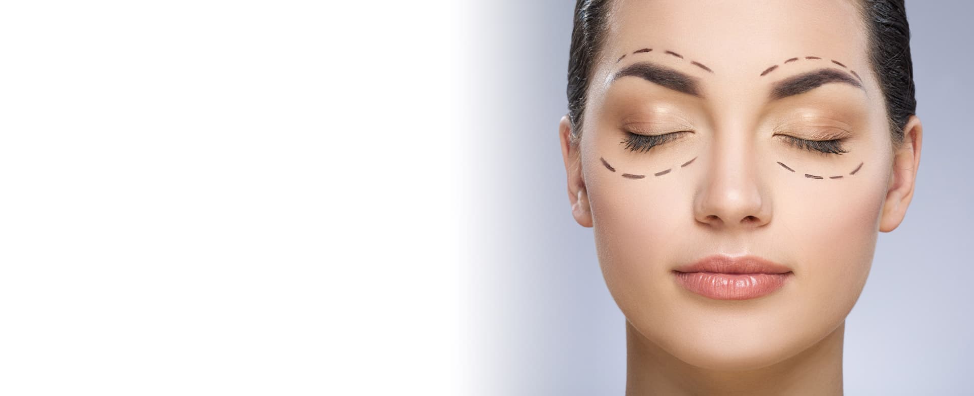 Blefaroplastia en Santiago y Pontevedra